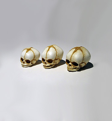 fetus at 12 weeks. Baby Skull - 12 weeks